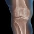 How NAD+ Can Influence Arthritis and Support Better Joint Health
